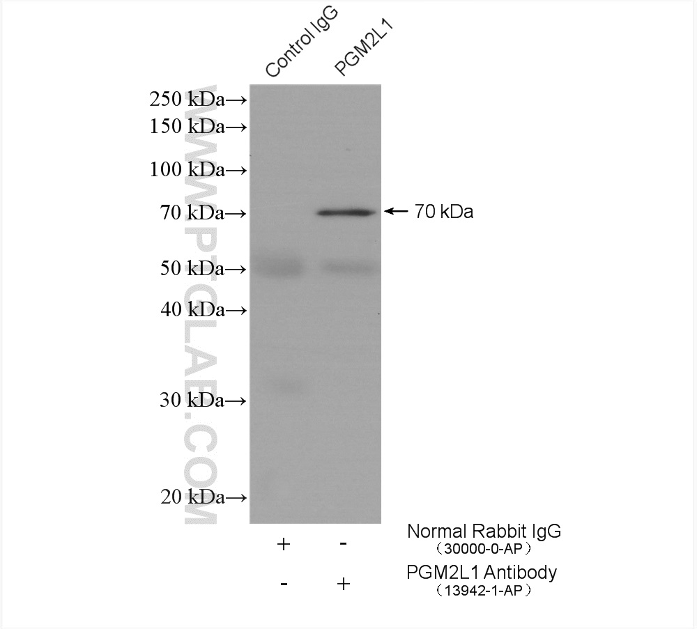 IP experiment of mouse brain using 13942-1-AP