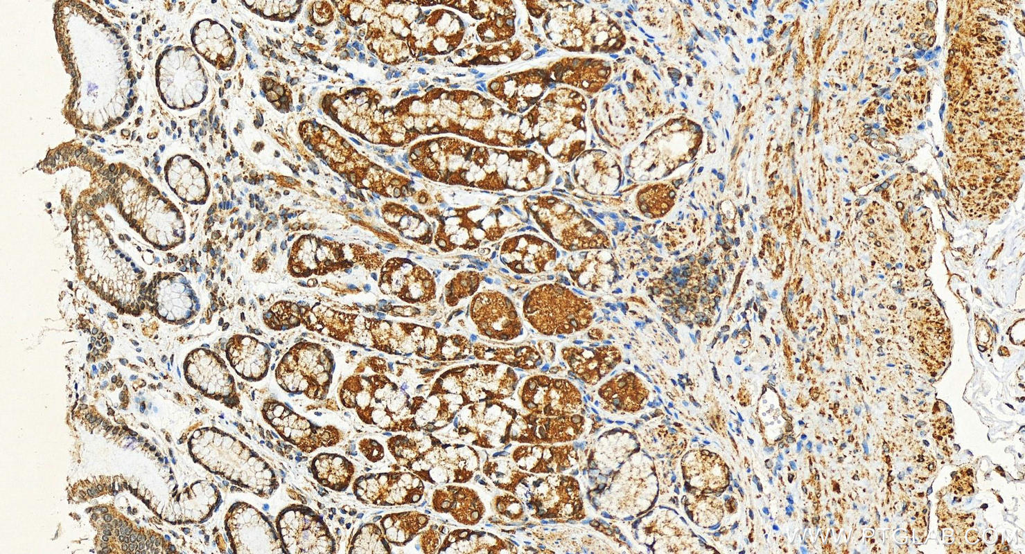 IHC staining of human stomach using 82965-1-RR (same clone as 82965-1-PBS)