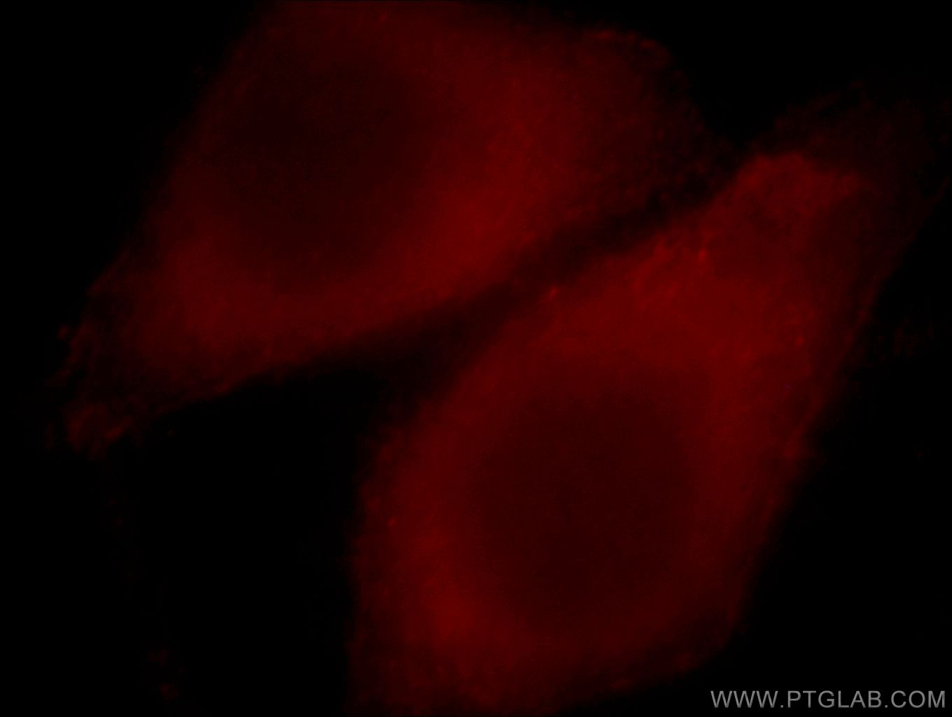 IF Staining of HepG2 using 19566-1-AP