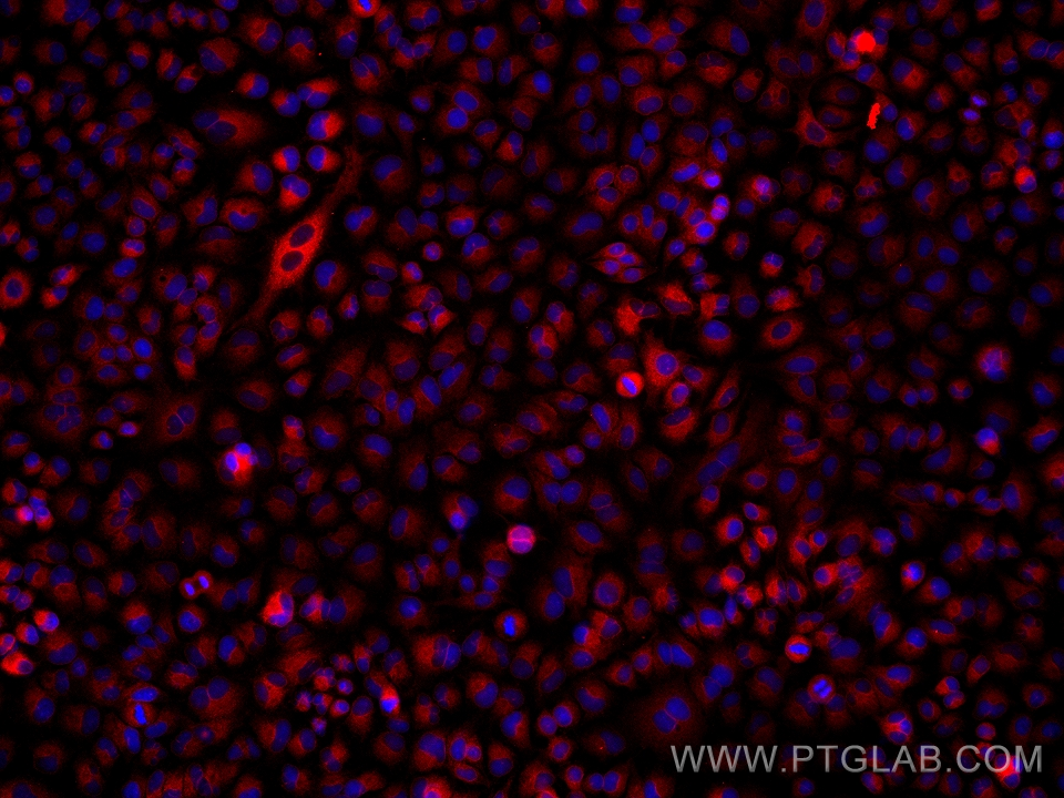 IF Staining of A549 using 66372-1-Ig (same clone as 66372-1-PBS)