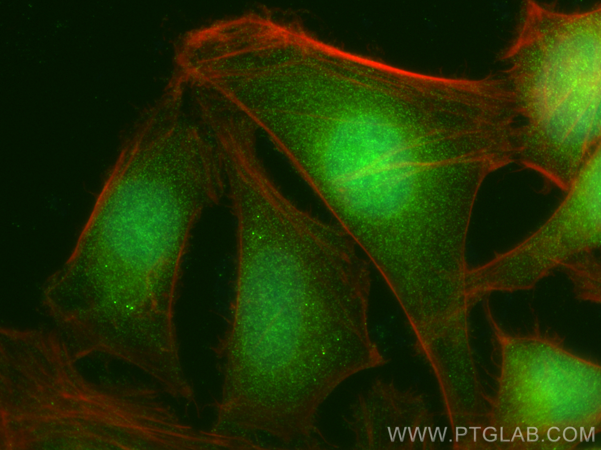 IF Staining of HeLa using 24575-1-AP