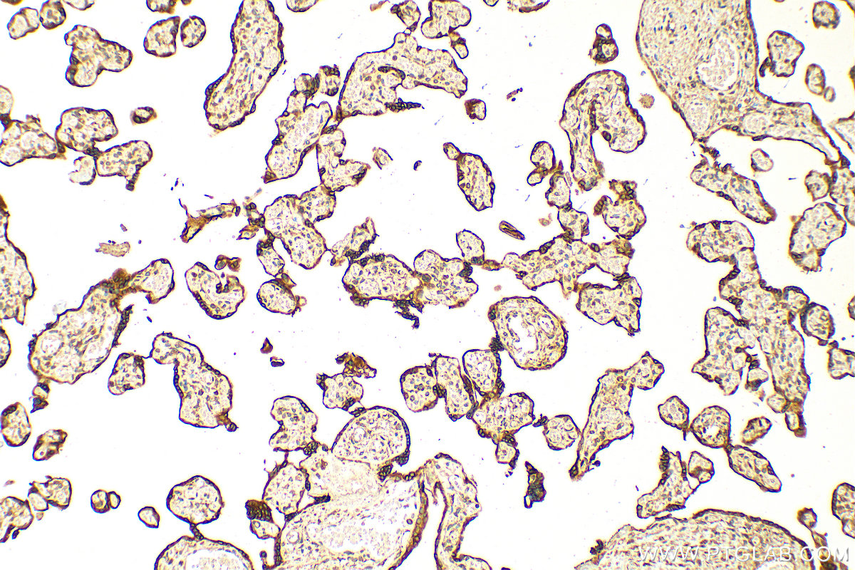 IHC staining of human placenta using 24575-1-AP