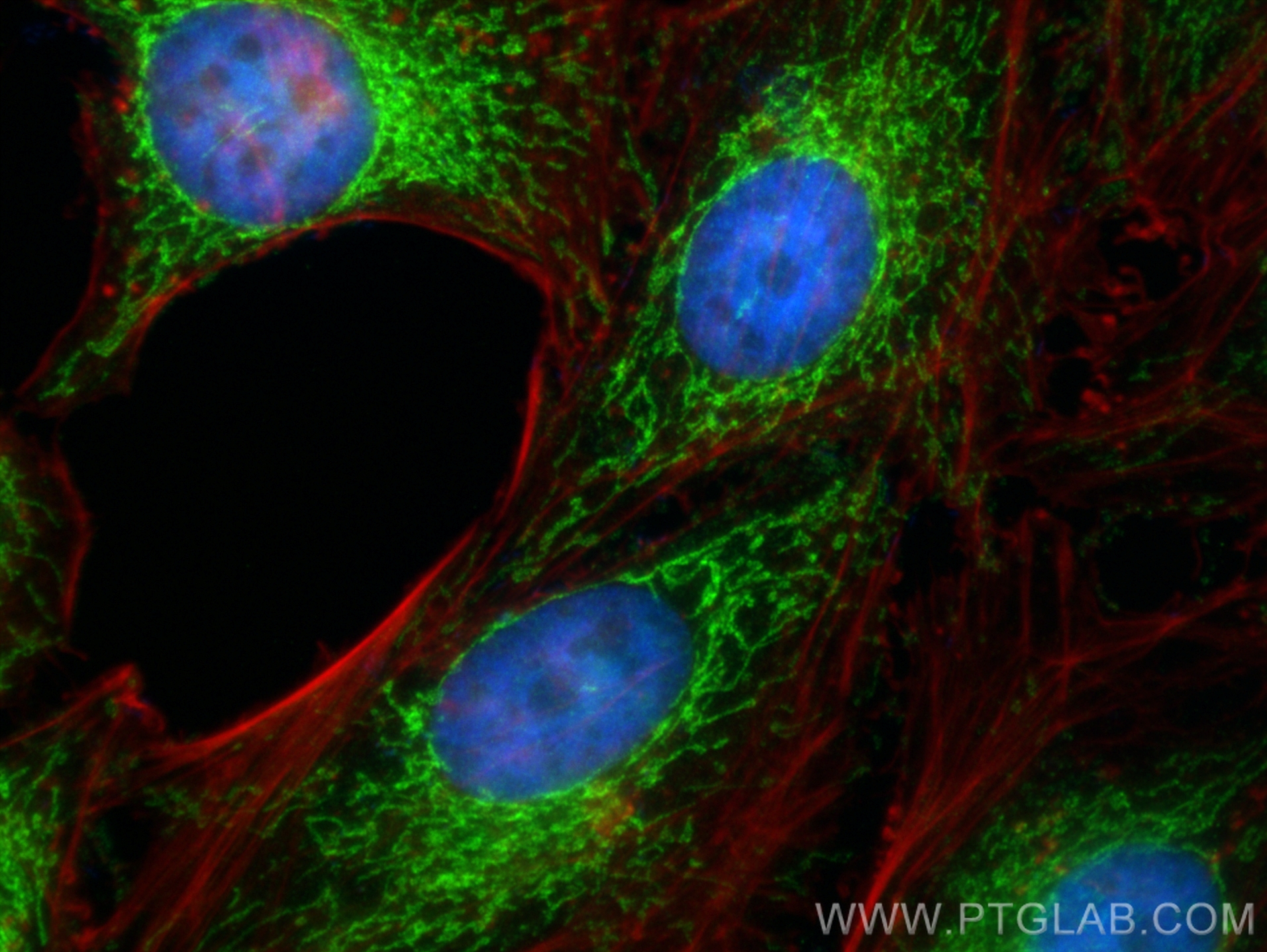 IF Staining of HeLa using 10787-1-AP