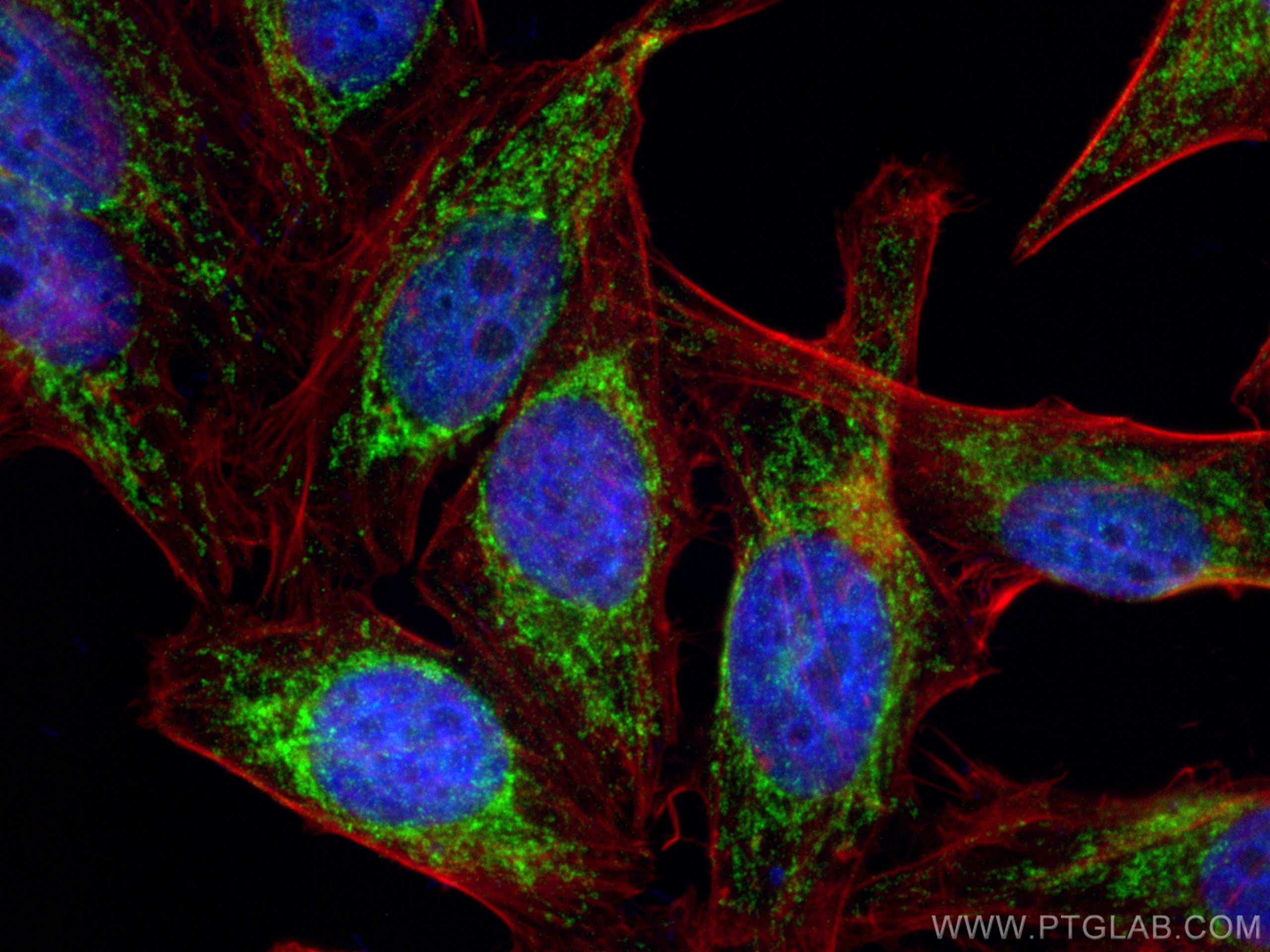 IF Staining of HepG2 using 12295-1-AP