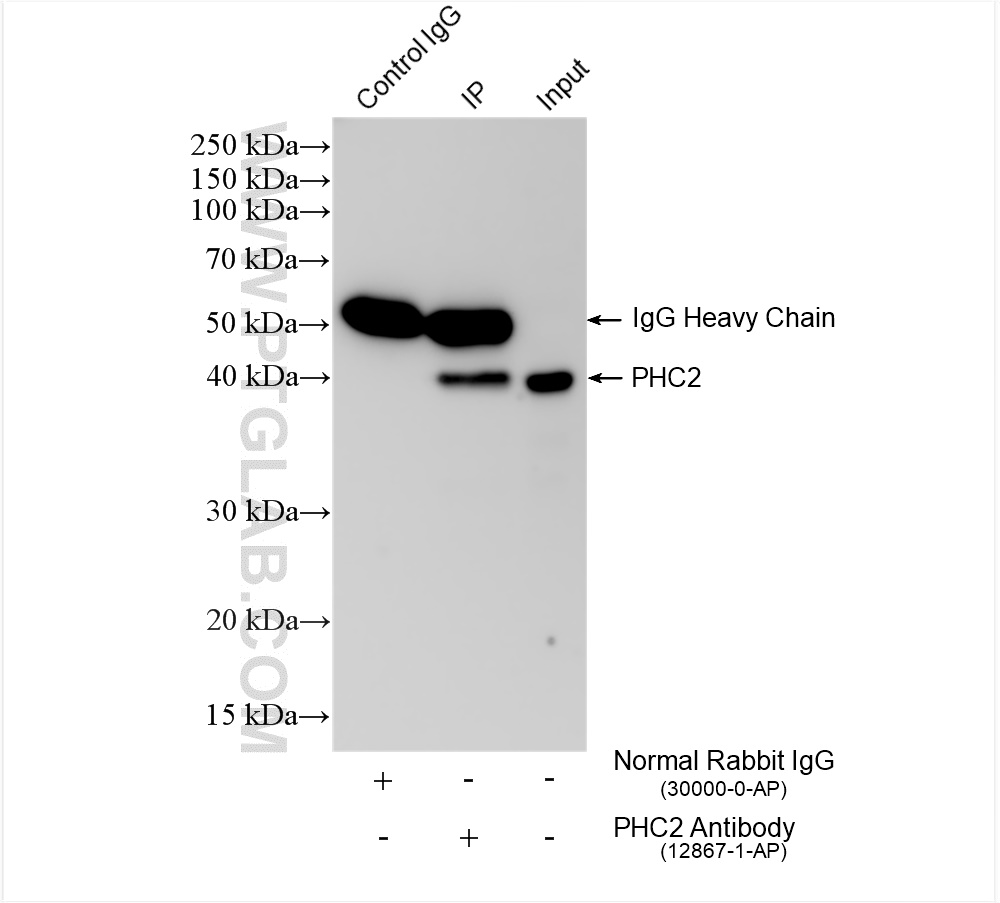 IP experiment of HL-60 using 12867-1-AP