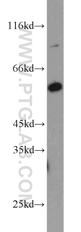 WB analysis of HeLa using 15032-1-AP