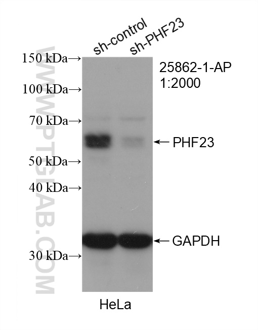 WB analysis of HeLa using 25862-1-AP