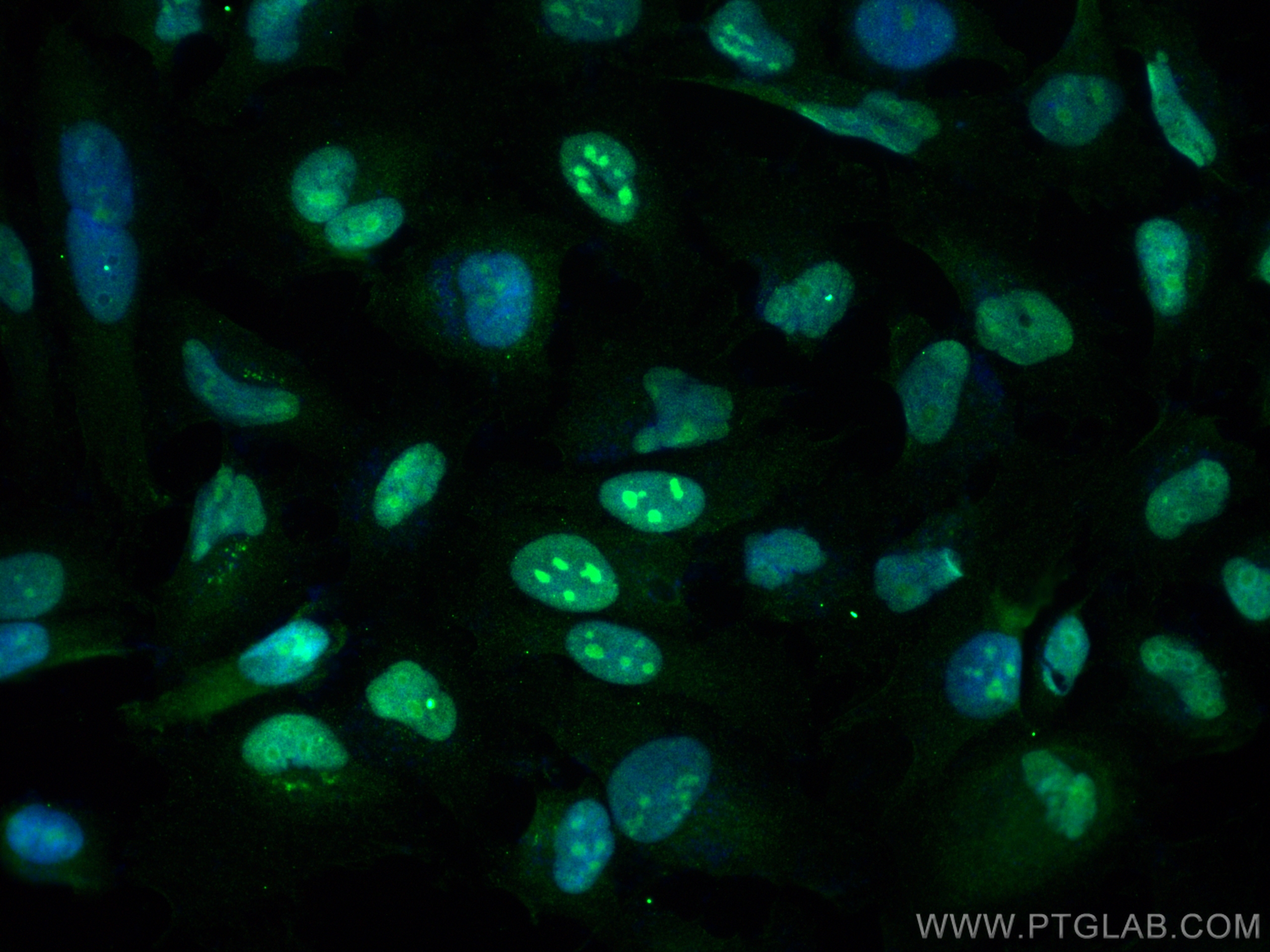 IF Staining of HeLa using 51062-1-AP