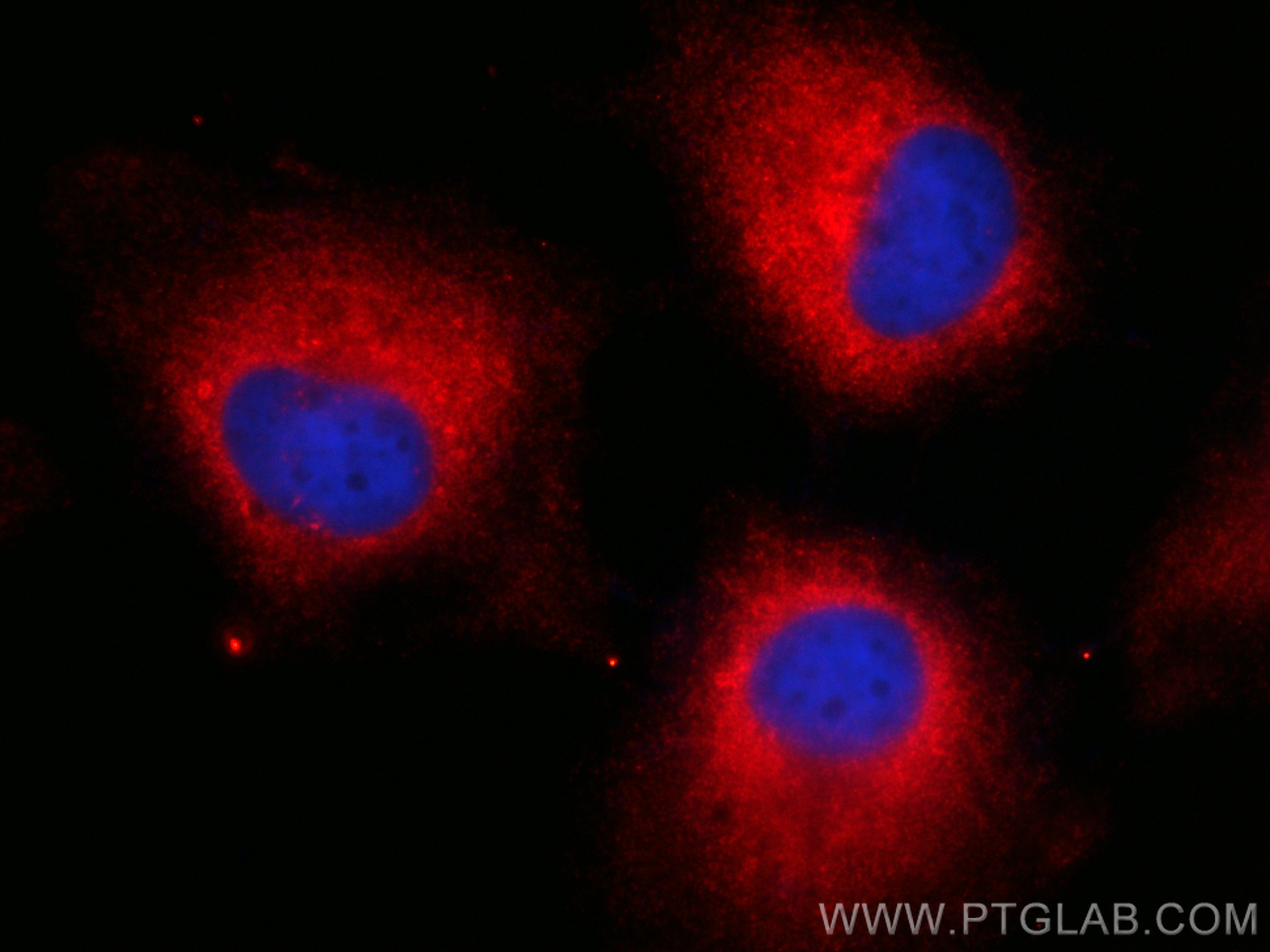 IF Staining of HeLa using CL594-67591