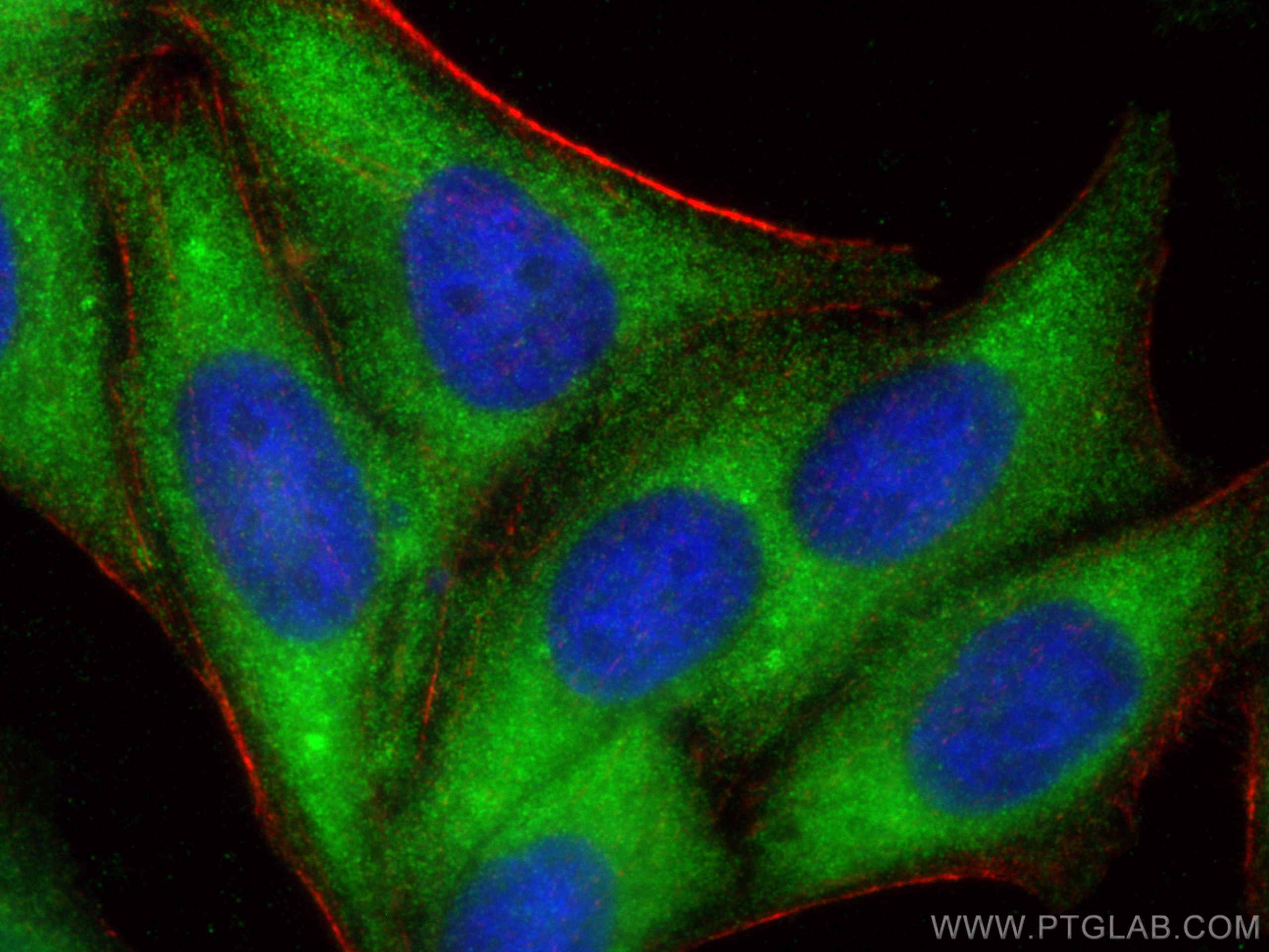 IF Staining of HepG2 using 24658-1-AP