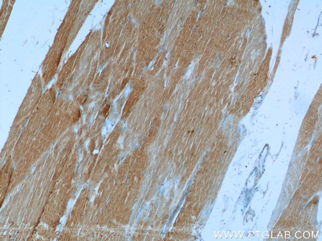 IHC staining of human skeletal muscle using 13400-1-AP