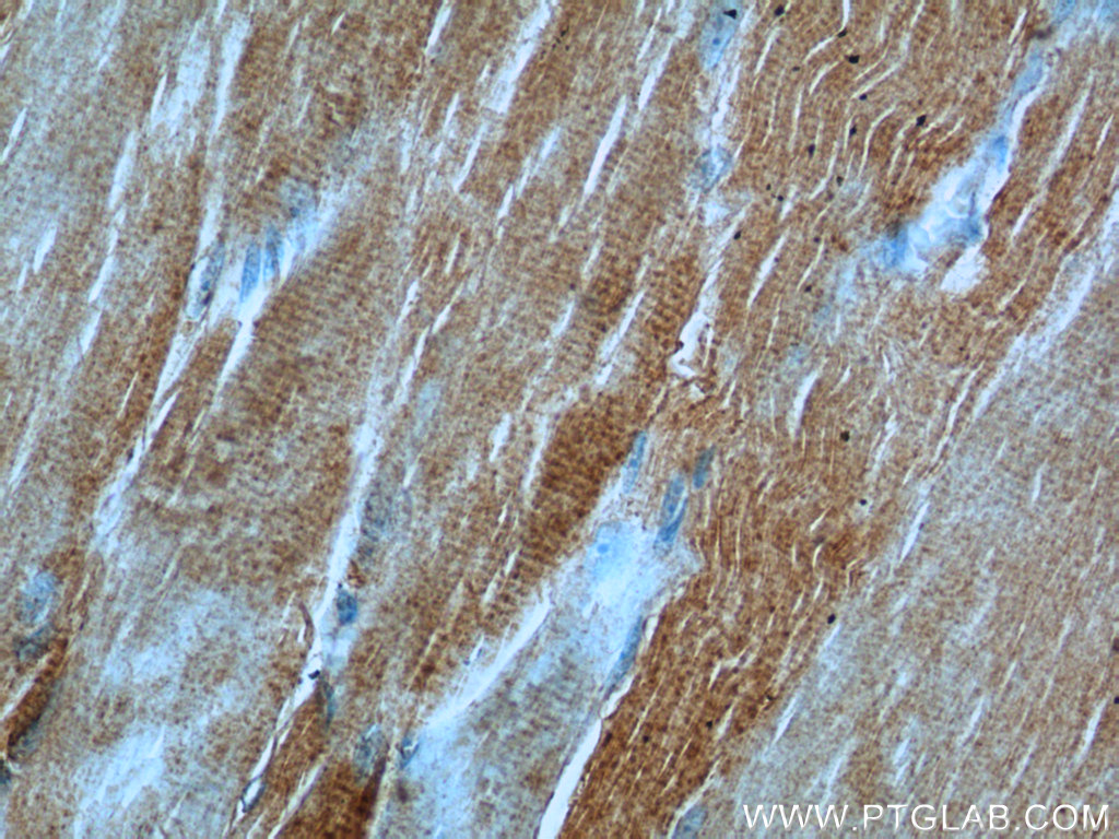 IHC staining of human skeletal muscle using 13400-1-AP