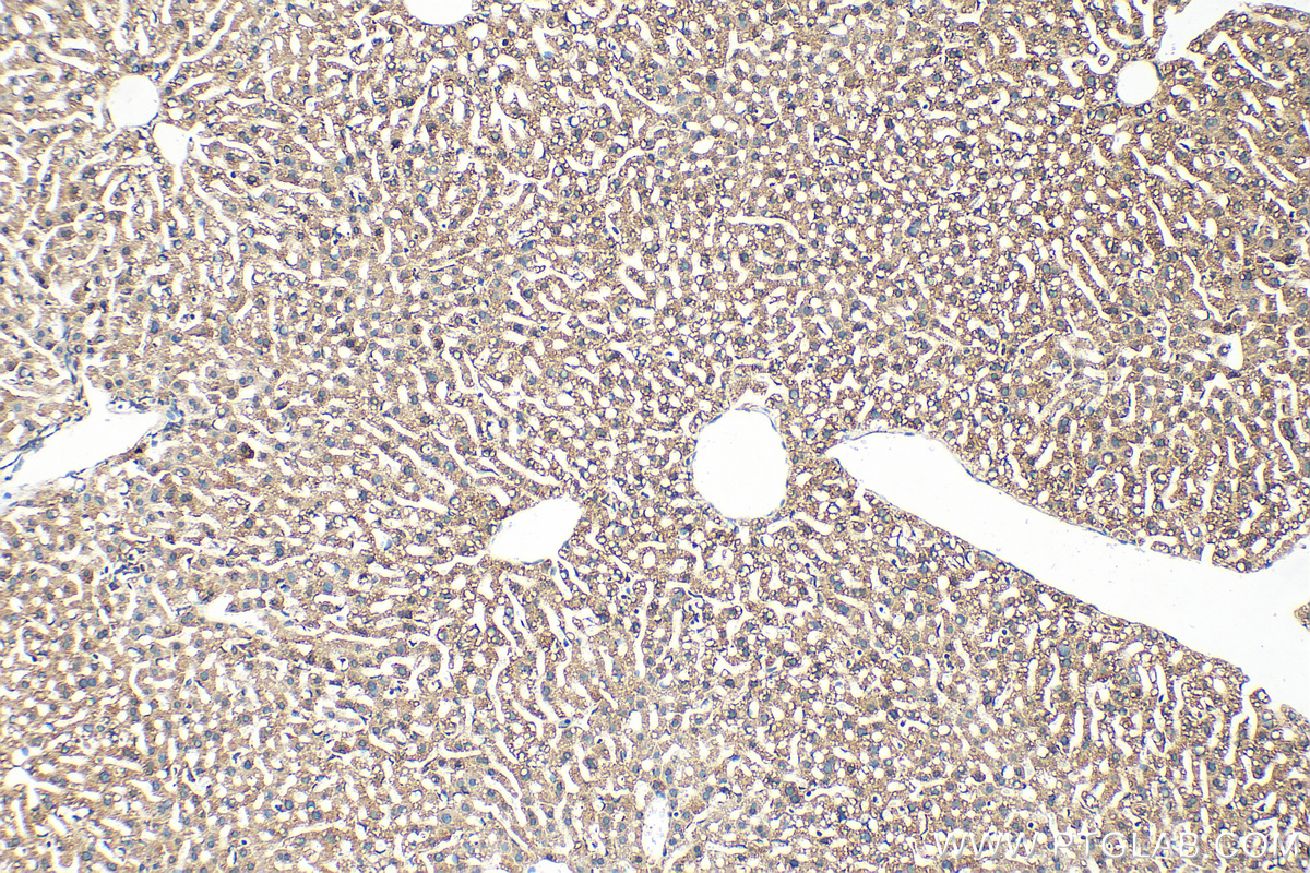 IHC staining of mouse liver using 13400-1-AP