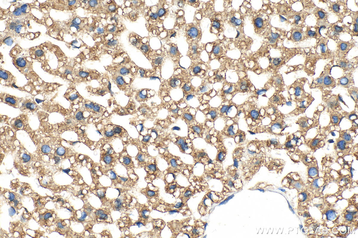 IHC staining of mouse liver using 13400-1-AP