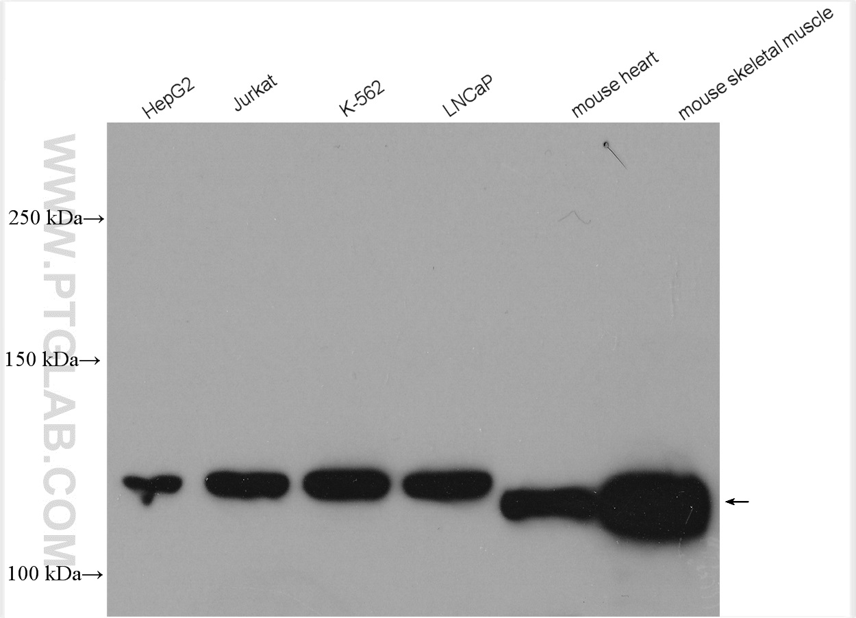 WB analysis of HepG2 using 13400-1-AP