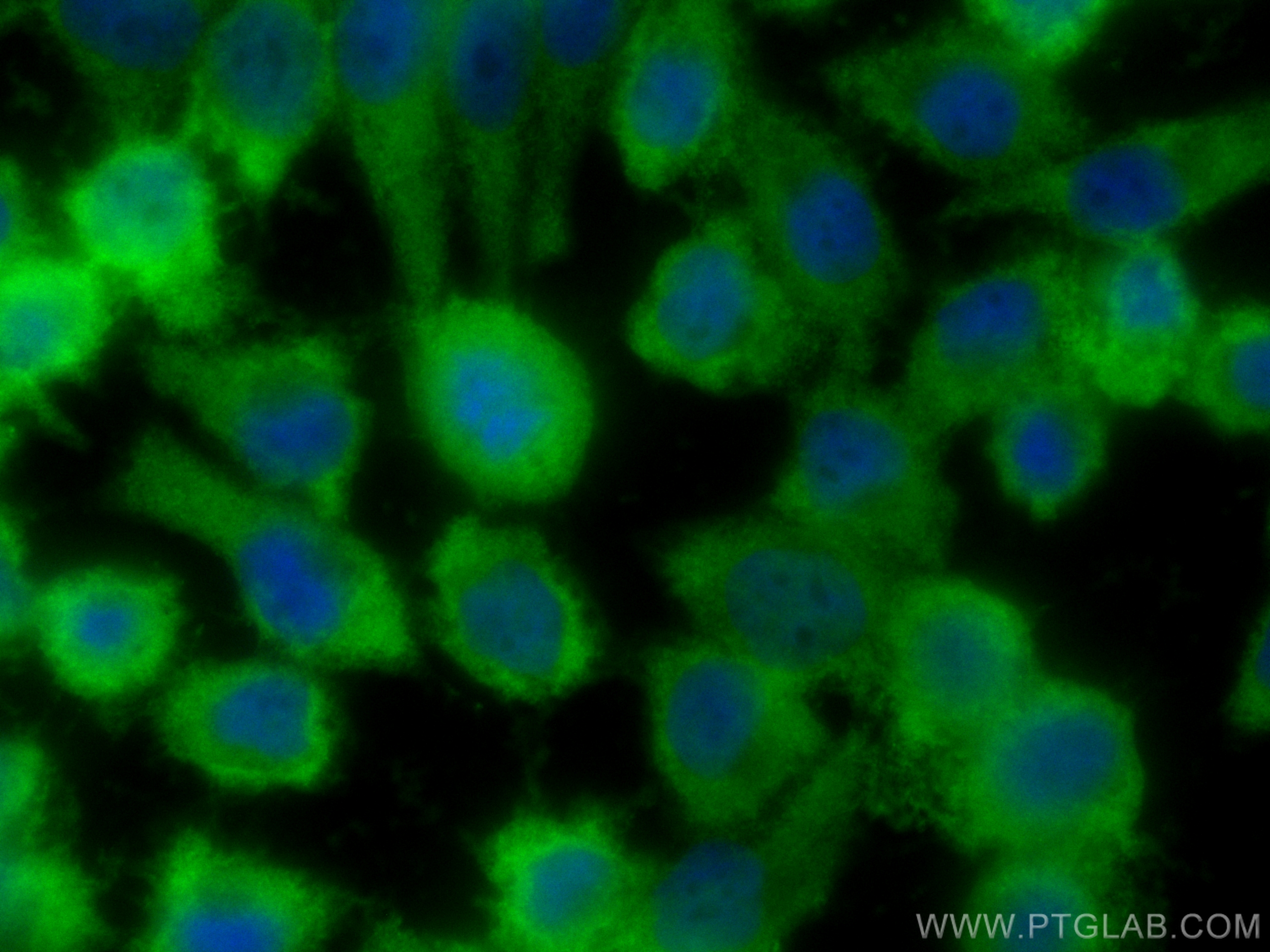 IF Staining of A375 using CL488-18263