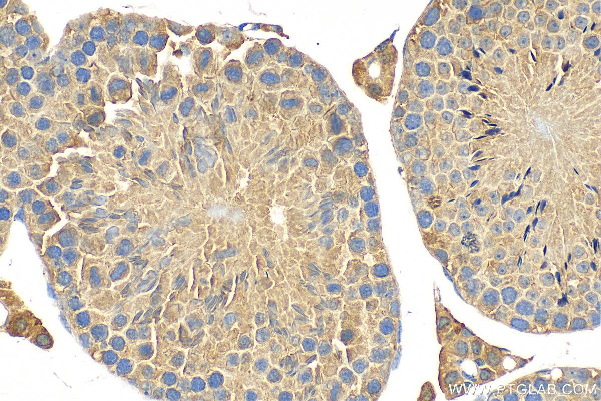 IHC staining of mouse testis using 11869-1-AP