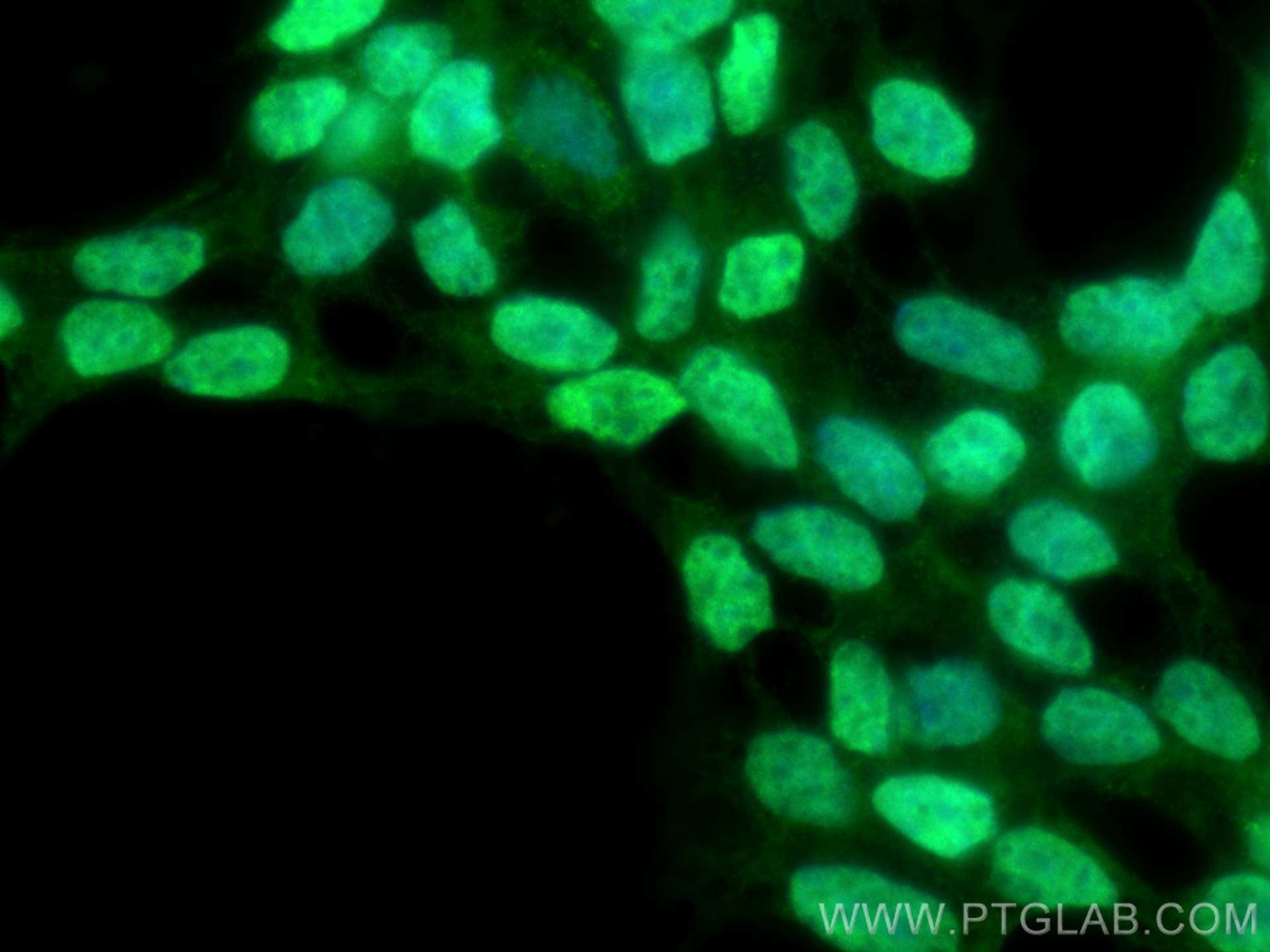 IF Staining of SH-SY5Y using 25276-1-AP