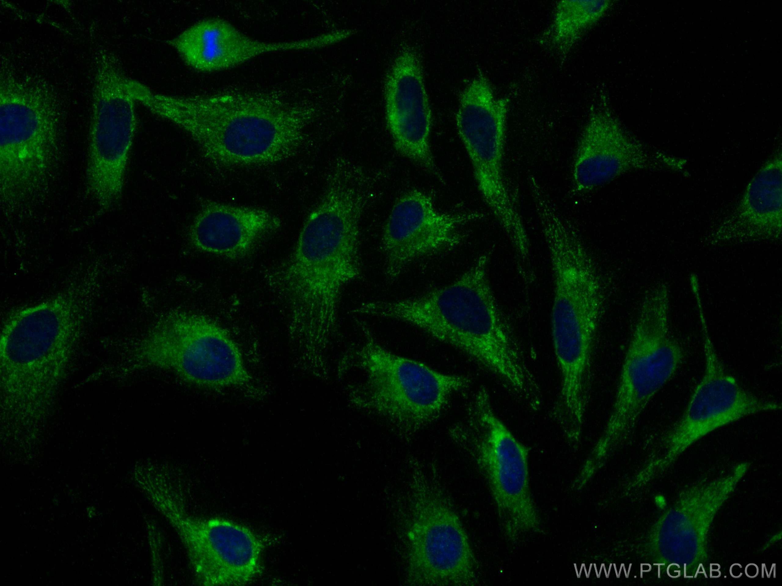 IF Staining of HeLa using 13112-1-AP