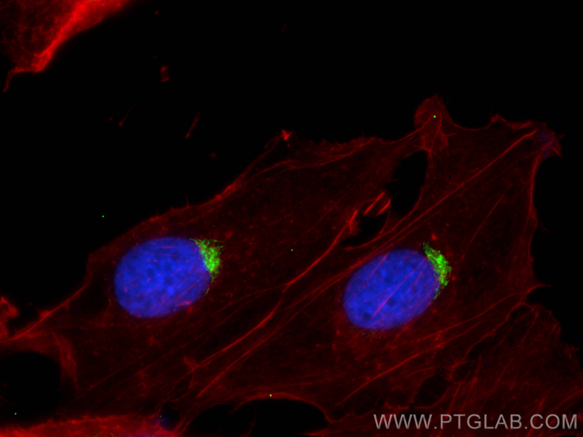 IF Staining of SKOV-3 using 30527-1-AP