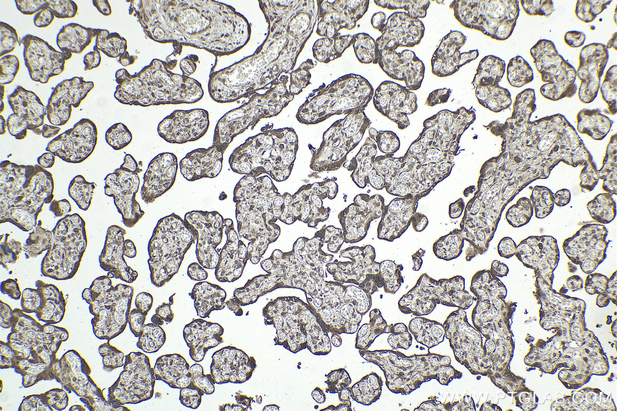 IHC staining of human placenta using 25868-1-AP