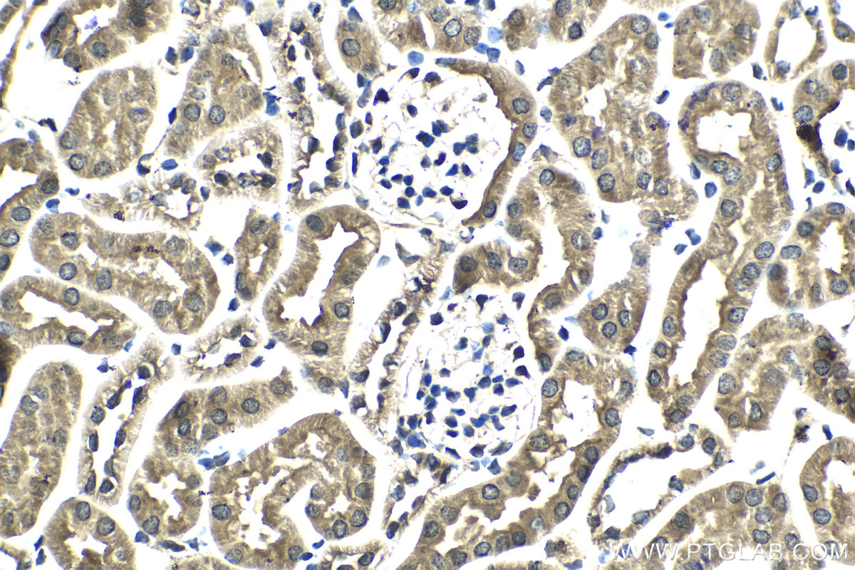 IHC staining of mouse kidney using 25868-1-AP