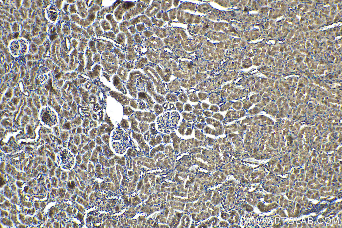 IHC staining of rat kidney using 25868-1-AP
