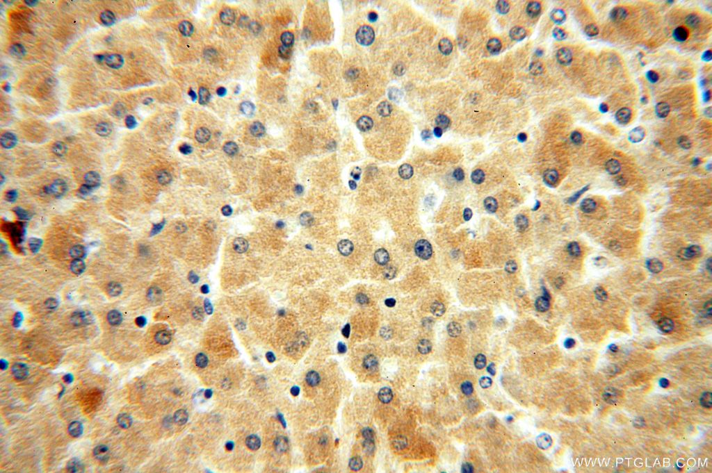 IHC staining of human liver using 15074-1-AP