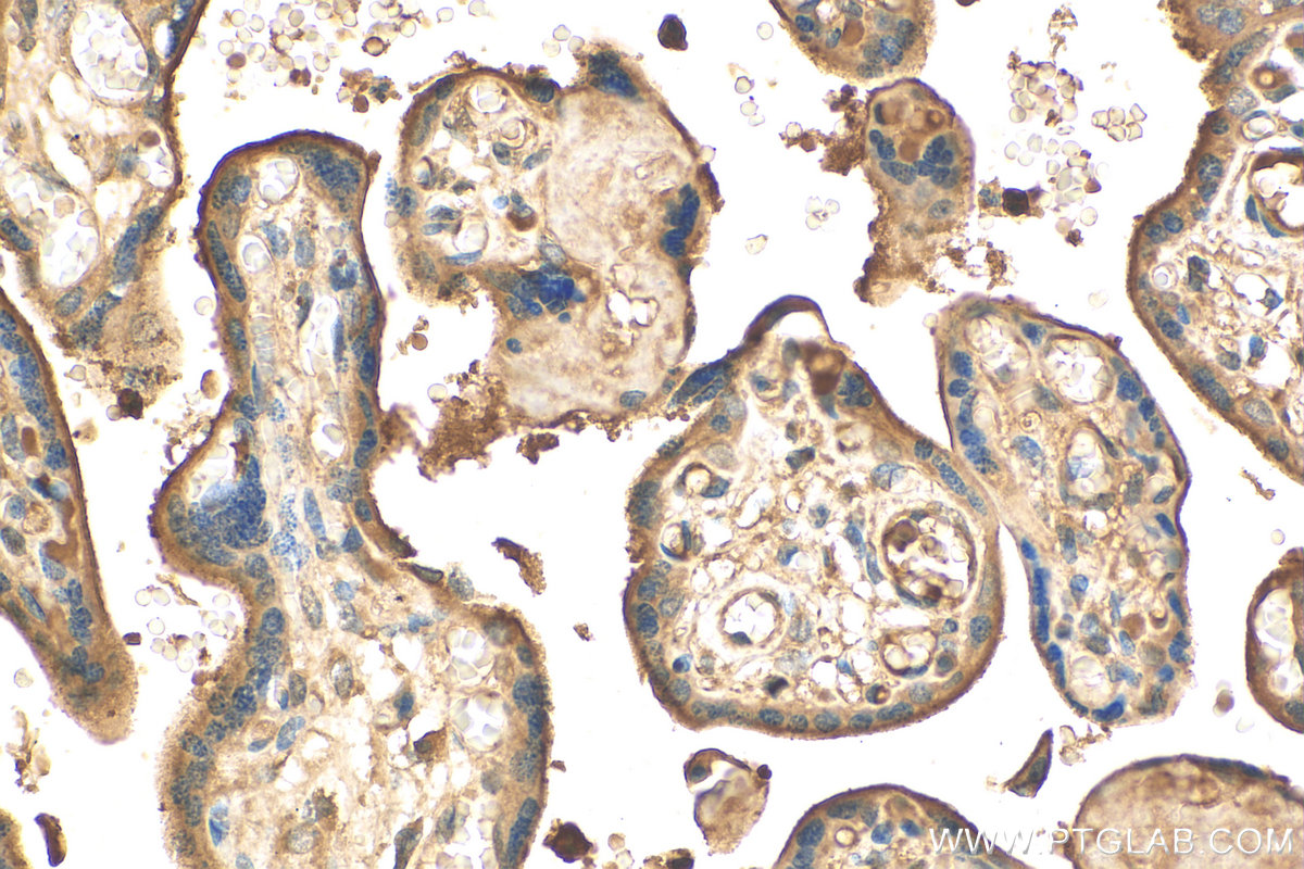 IHC staining of human placenta using 12411-1-AP