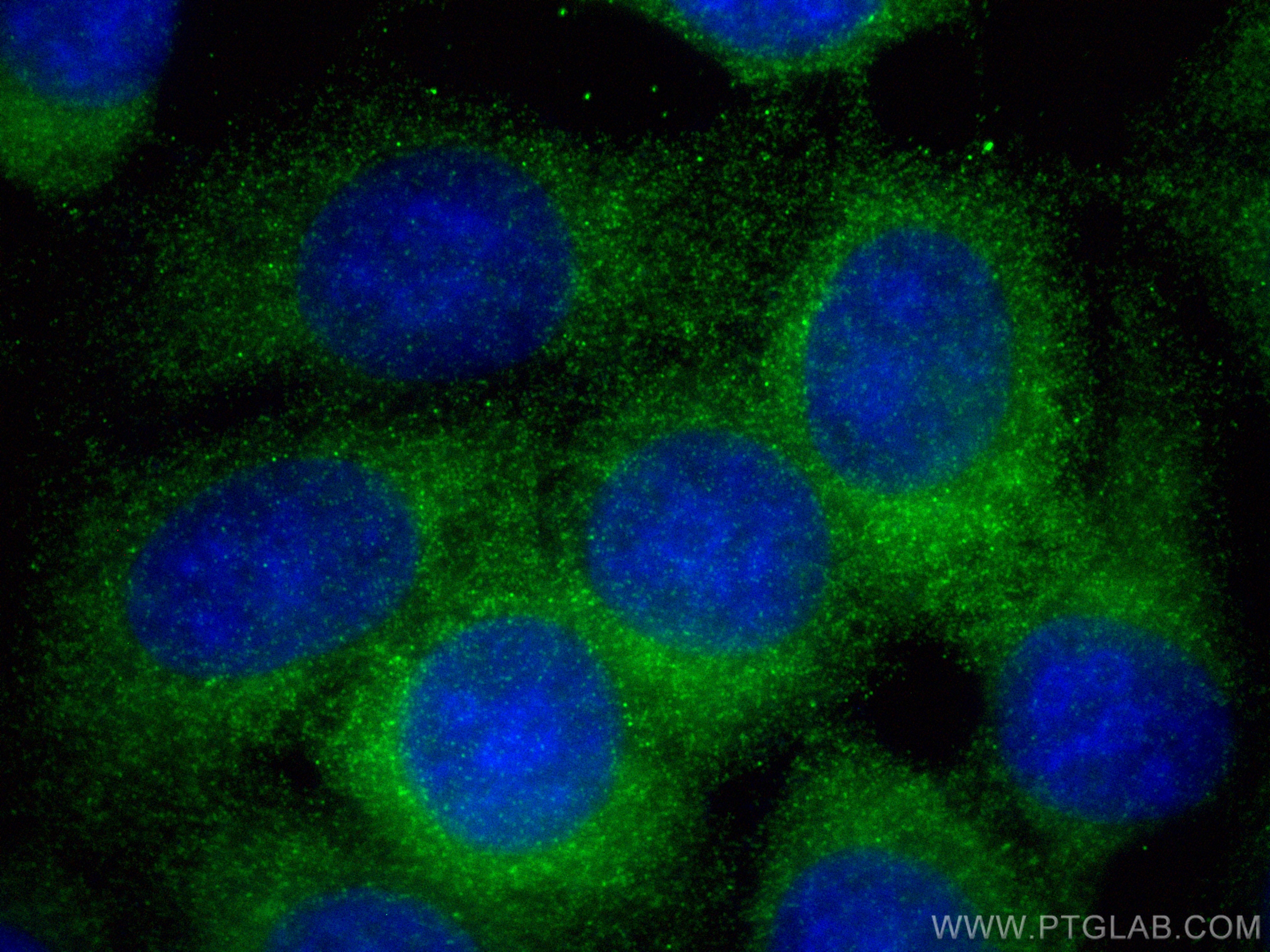 IF Staining of MCF-7 using 82938-1-RR