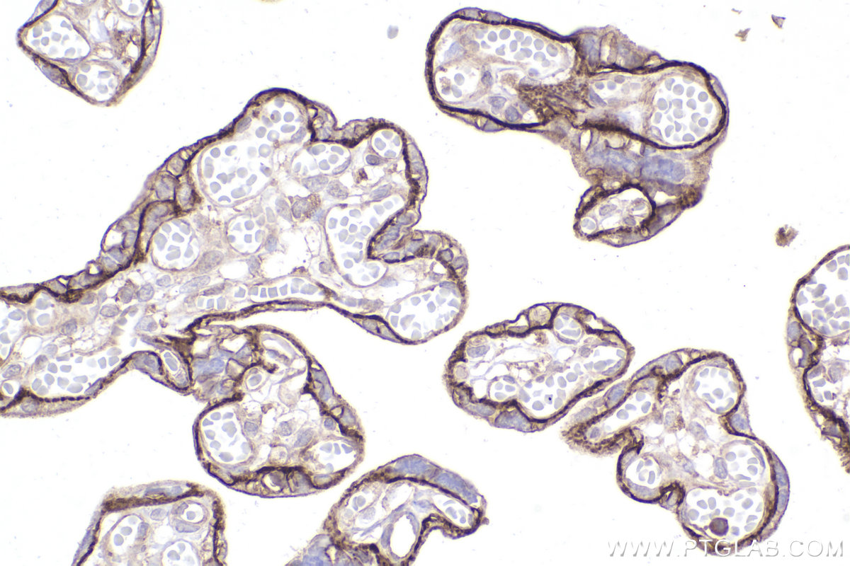 IHC staining of human placenta using 82938-1-RR