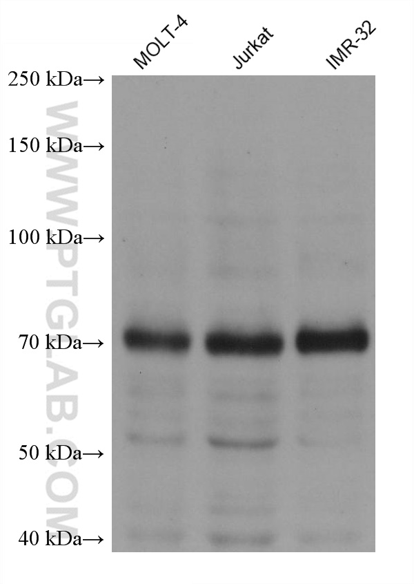 WB analysis using 60498-1-Ig