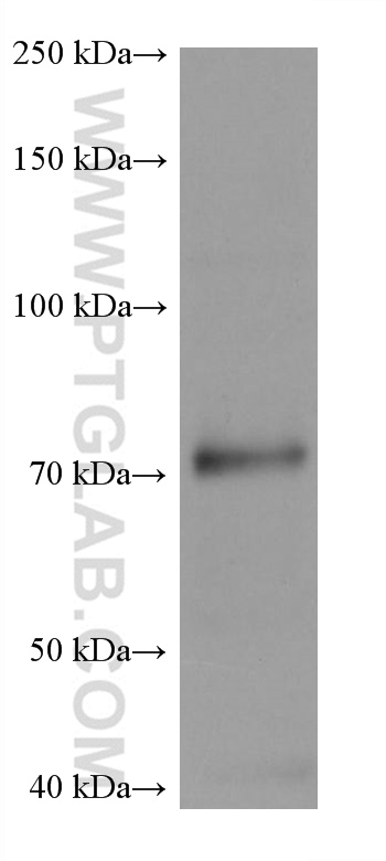 WB analysis of THP-1 using 60498-1-Ig (same clone as 60498-1-PBS)