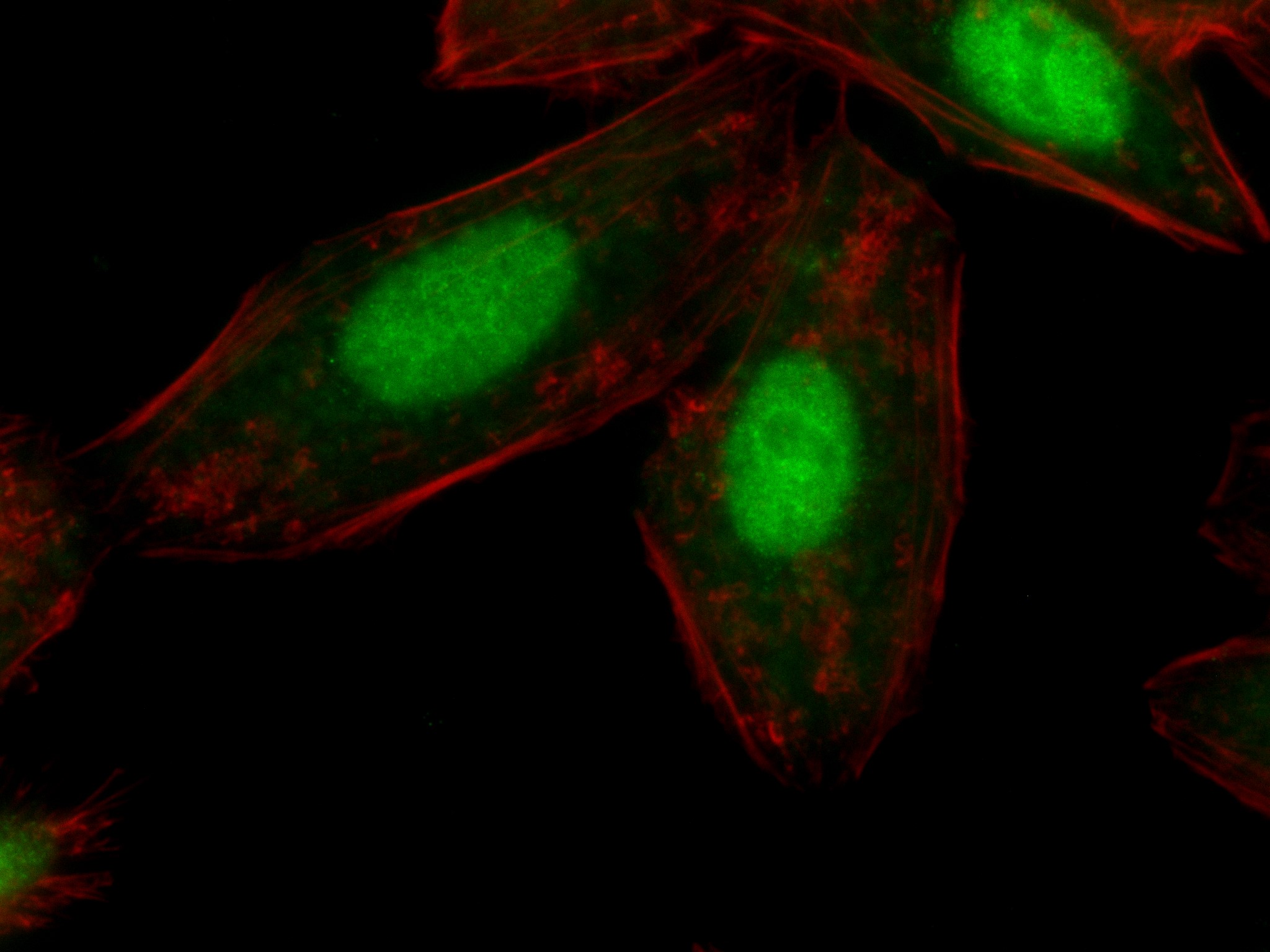 IF Staining of HepG2 using 82873-2-RR (same clone as 82873-2-PBS)