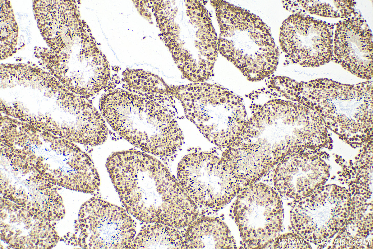 IHC staining of mouse testis using 82873-2-RR