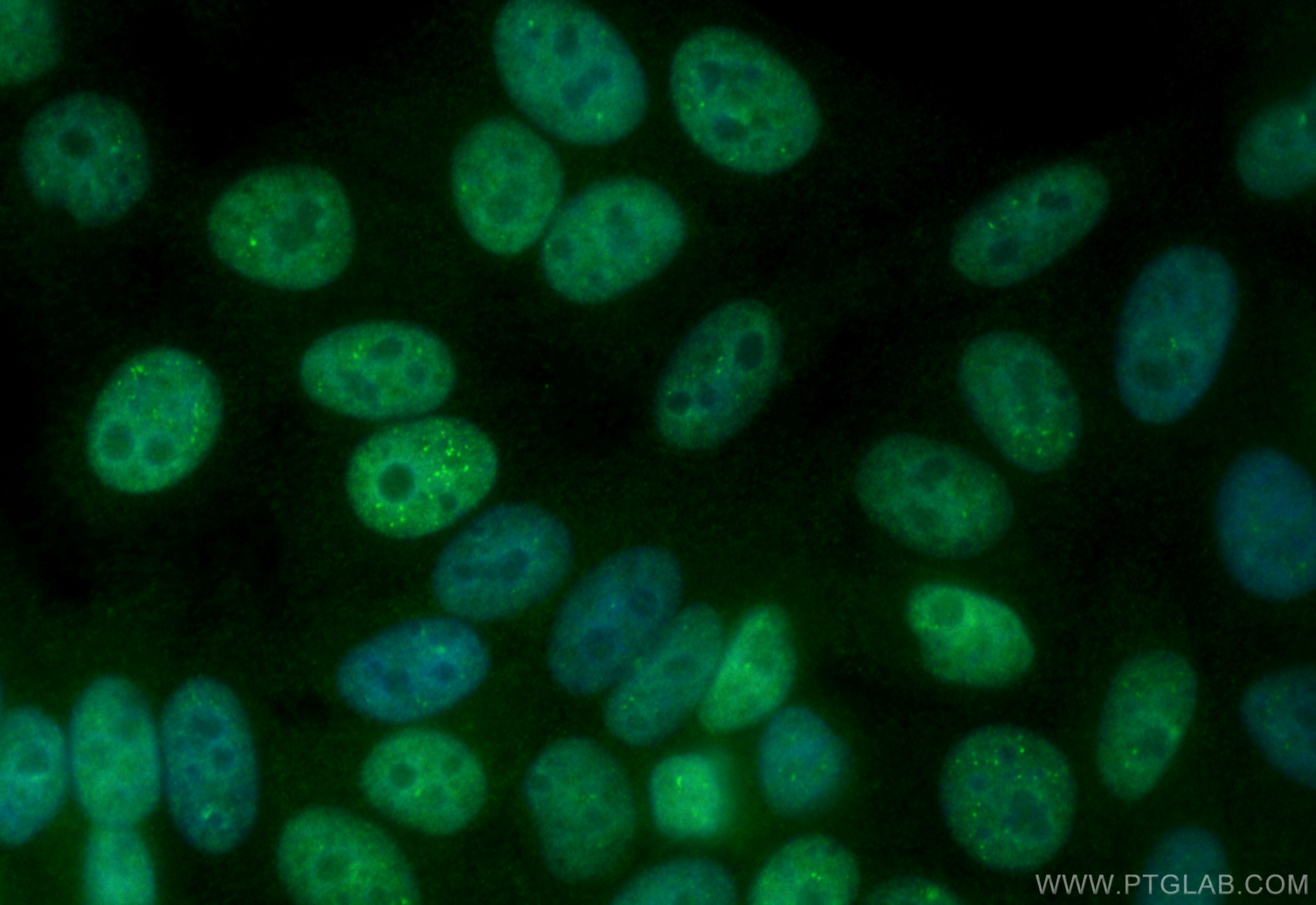 IF Staining of HepG2 using CL488-82873-2