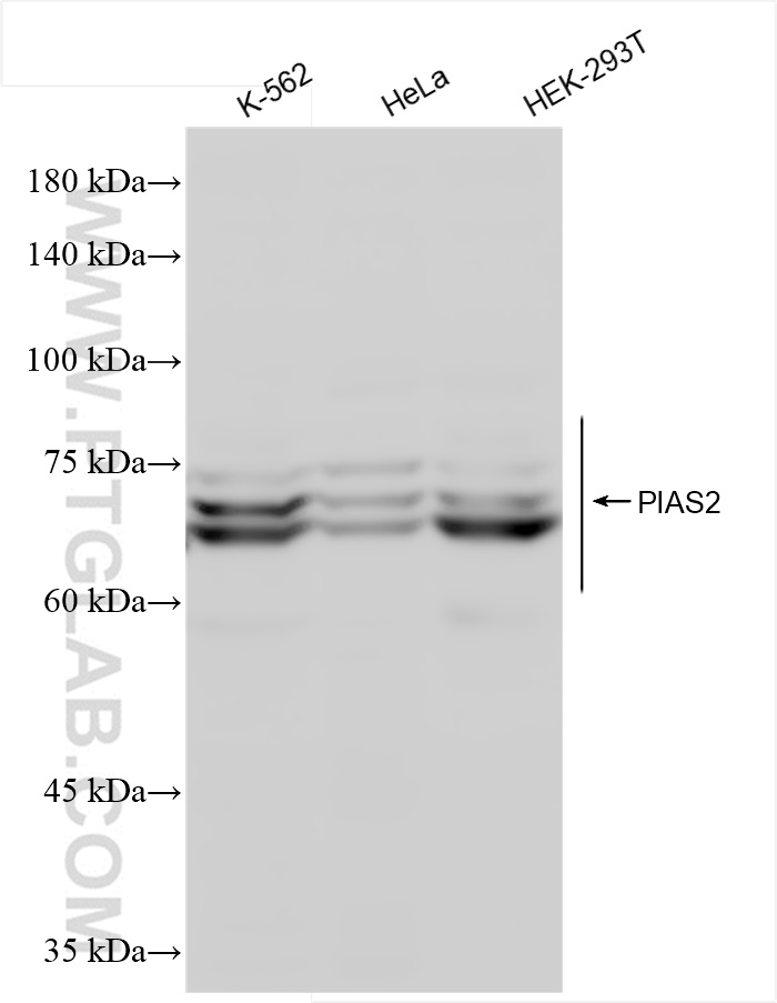 WB analysis using 84189-4-RR