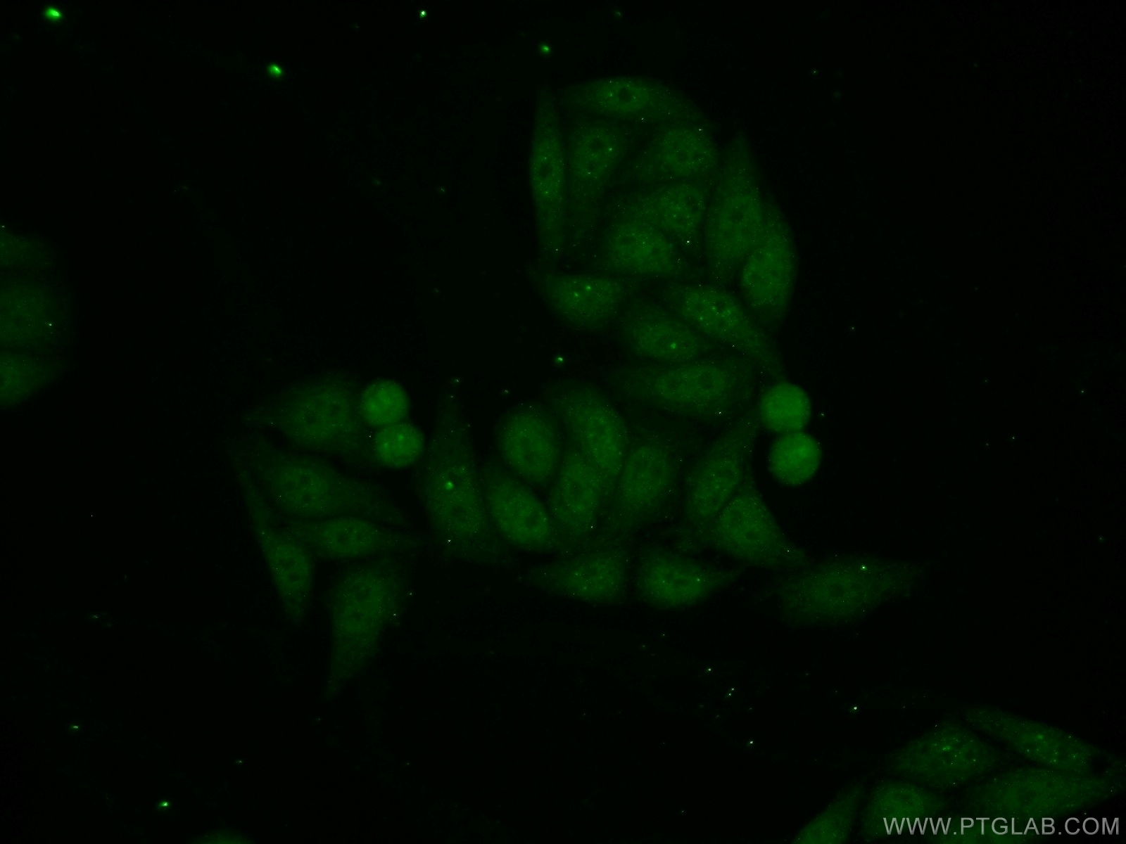 IF Staining of HepG2 using 13486-1-AP