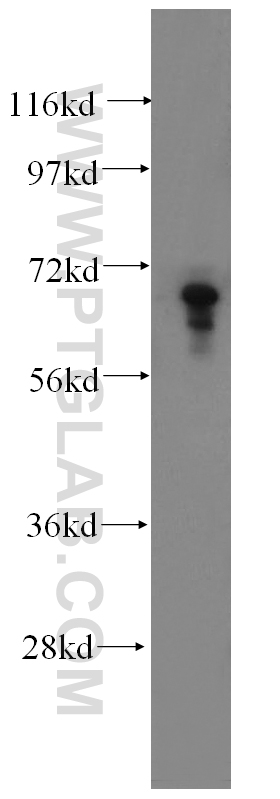 WB analysis of HepG2 using 13486-1-AP