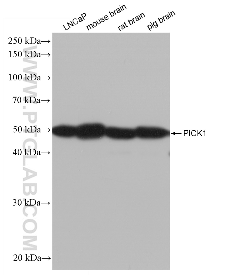 WB analysis using 82919-1-RR (same clone as 82919-1-PBS)