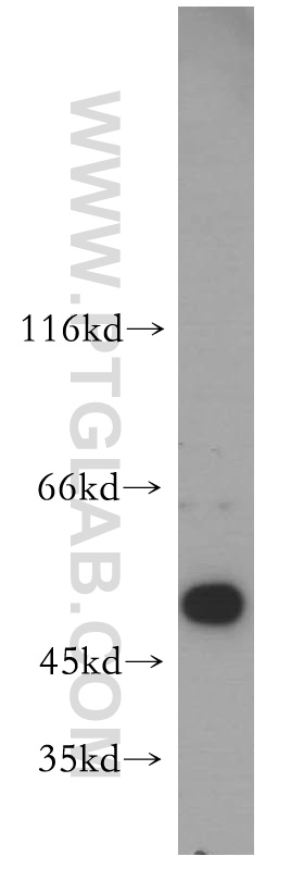 WB analysis of human liver using 12612-1-AP