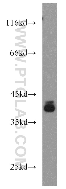 WB analysis of HT-1080 using 15151-1-AP