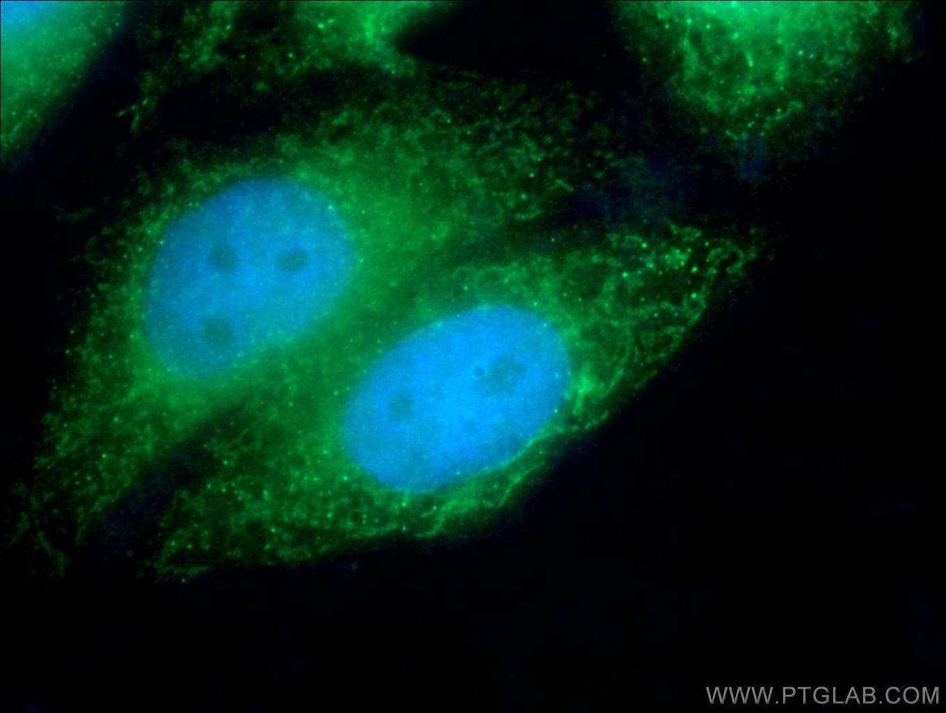 IF Staining of HepG2 using 18334-1-AP