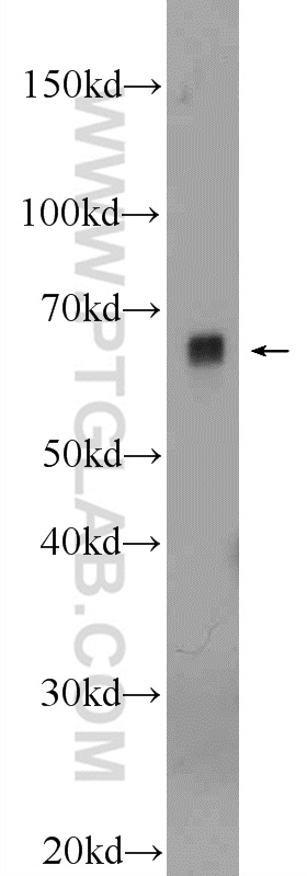 WB analysis of HeLa using 18334-1-AP