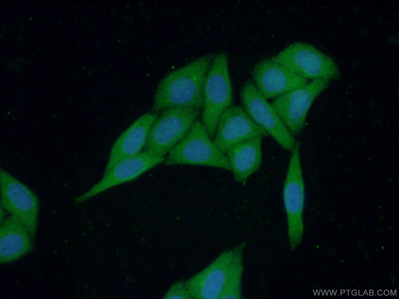 IF Staining of HepG2 using 17384-1-AP