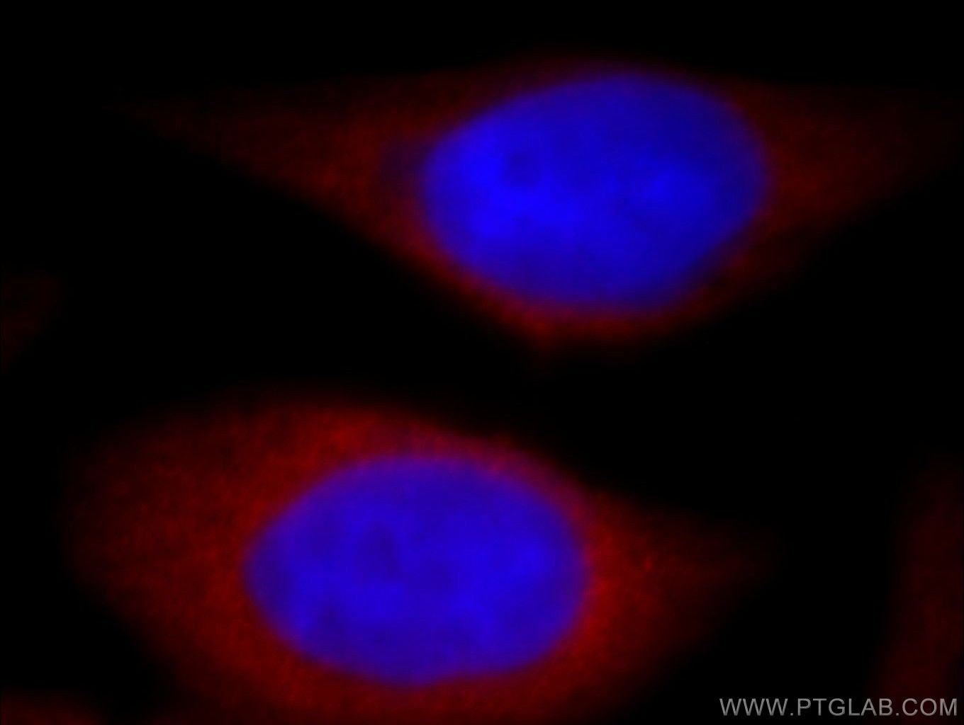 IF Staining of HeLa using 19427-1-AP