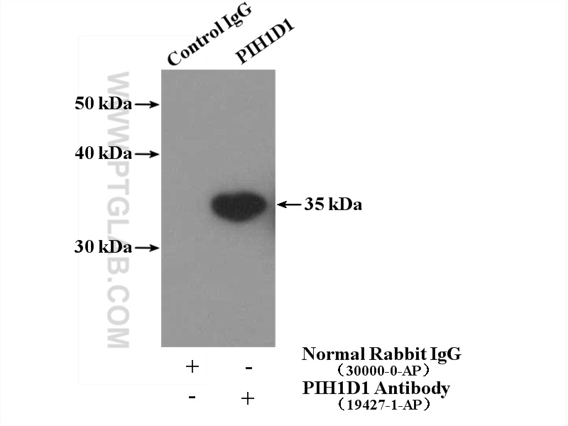 IP experiment of HeLa using 19427-1-AP