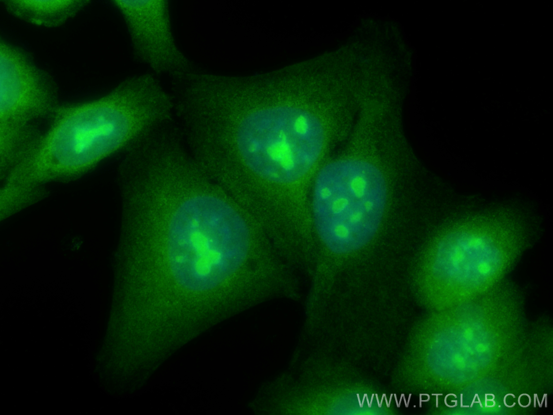 IF Staining of HepG2 using 20584-1-AP