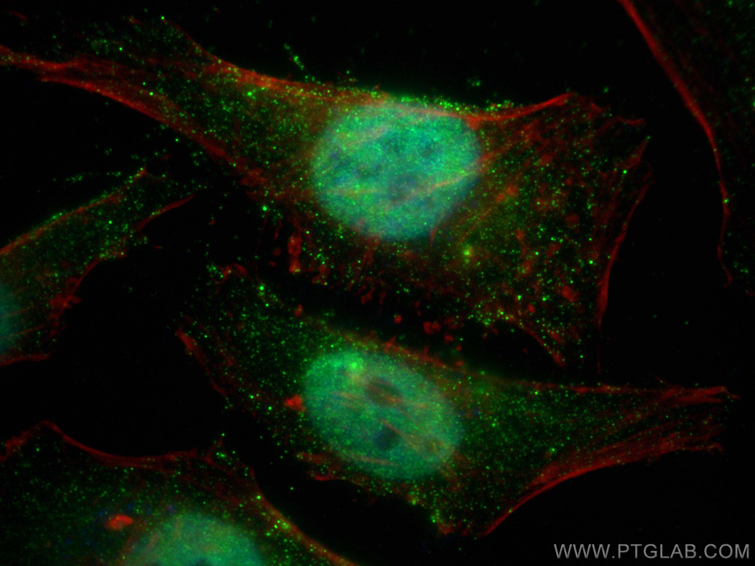 IF Staining of HeLa using 67121-1-Ig