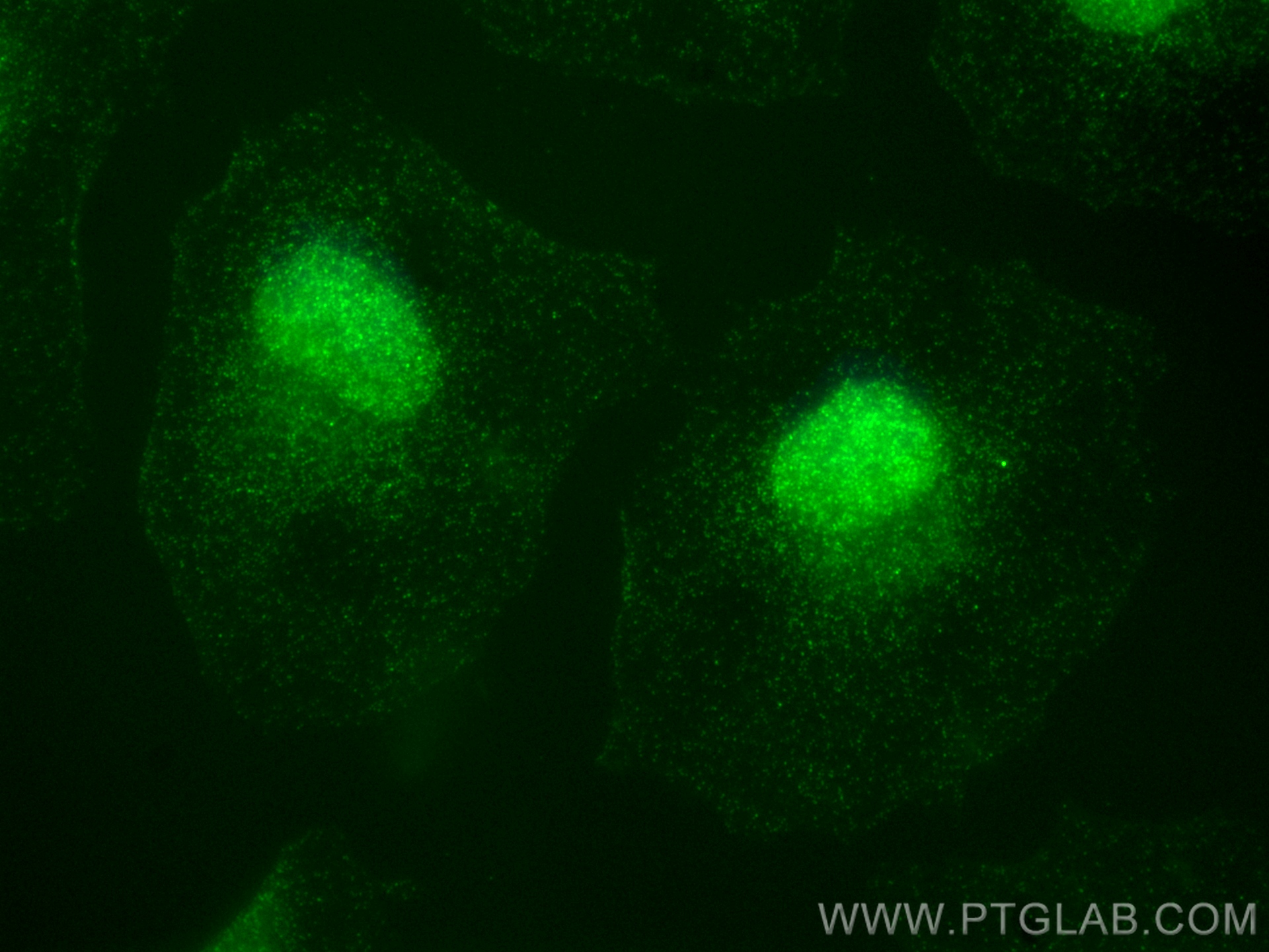 IF Staining of HeLa using 83606-5-RR